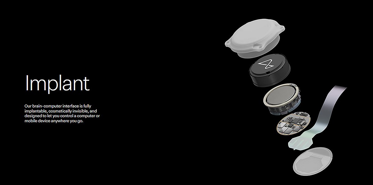 Кадр презентации глазного импланта. Фото: neuralink.com