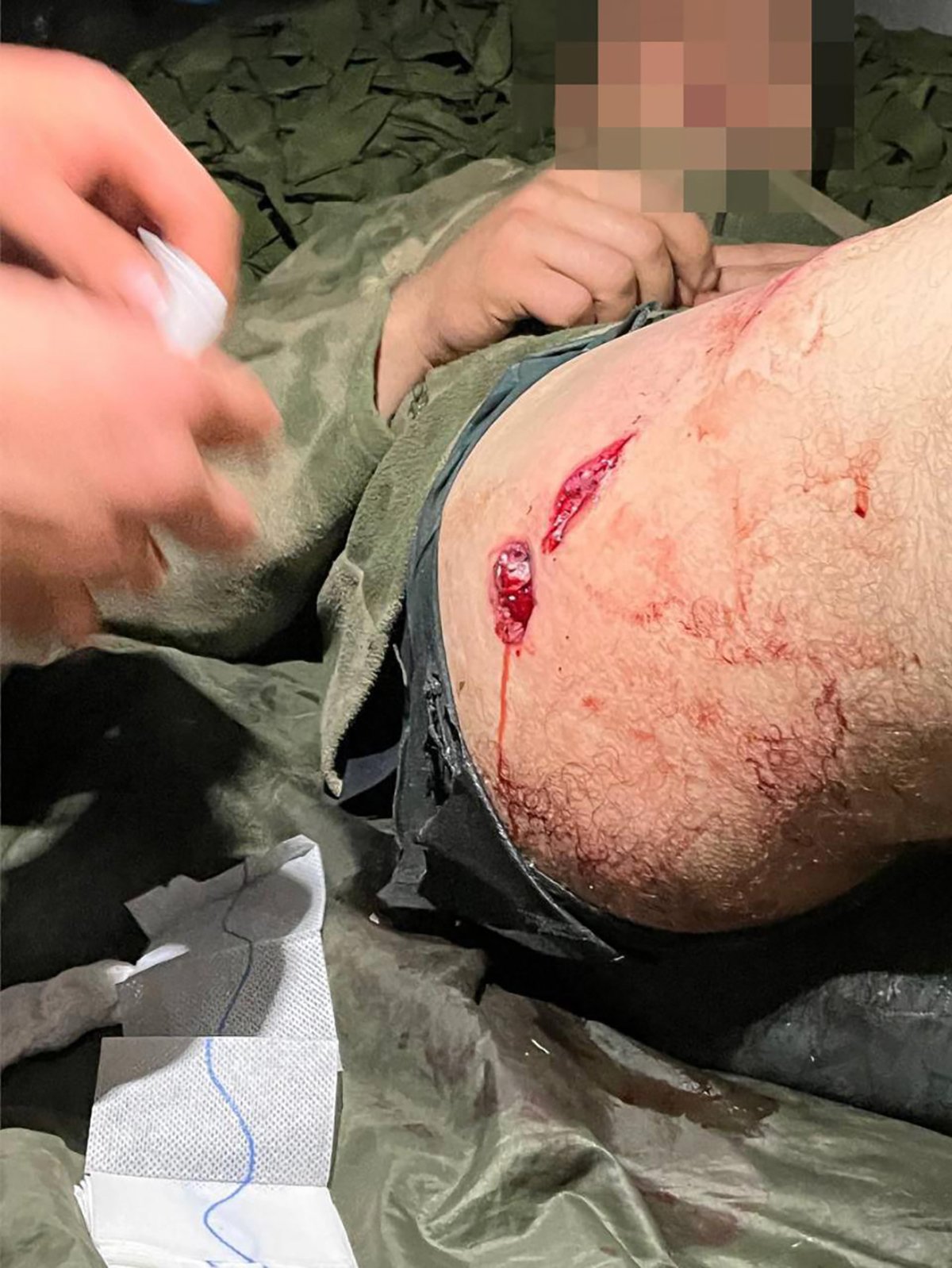 Оказание первой помощи товарищу Александра, которого он впоследствии помогал эвакуировать. Фото: личный архив Александра