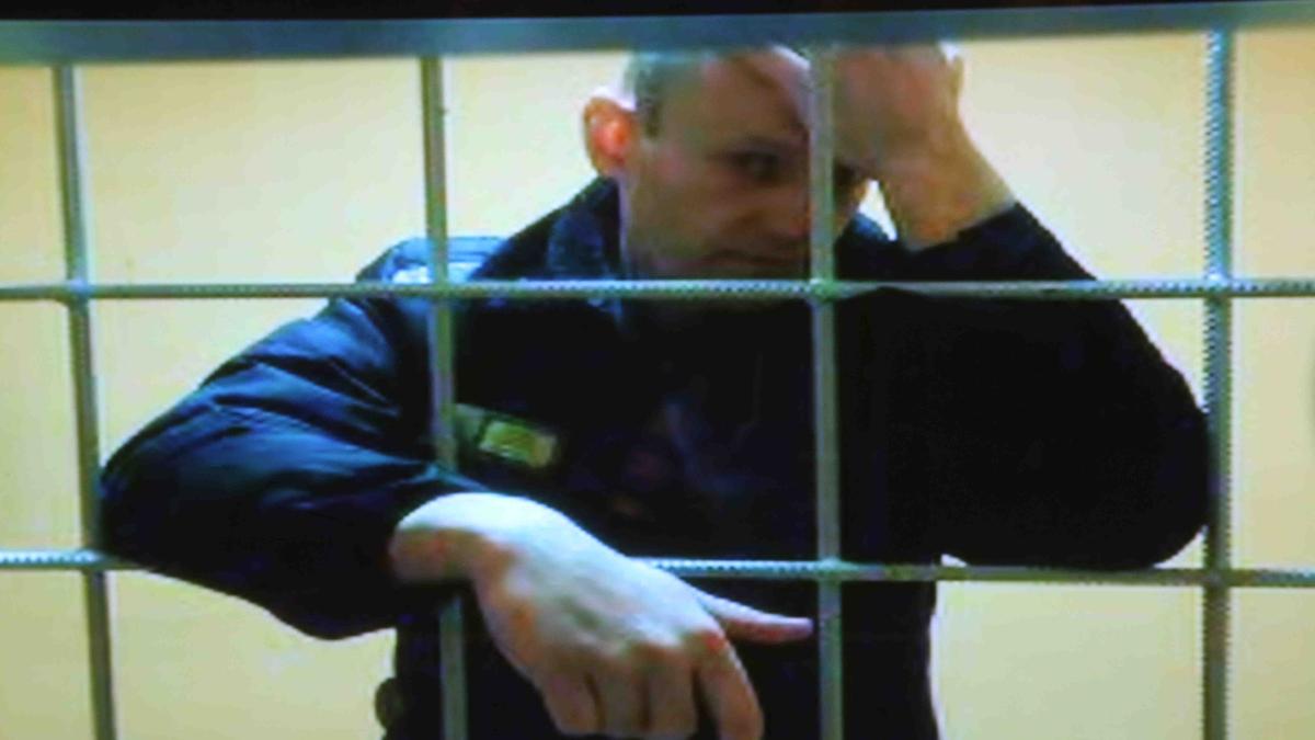 Источник: на теле Навального обнаружены синяки от судорог